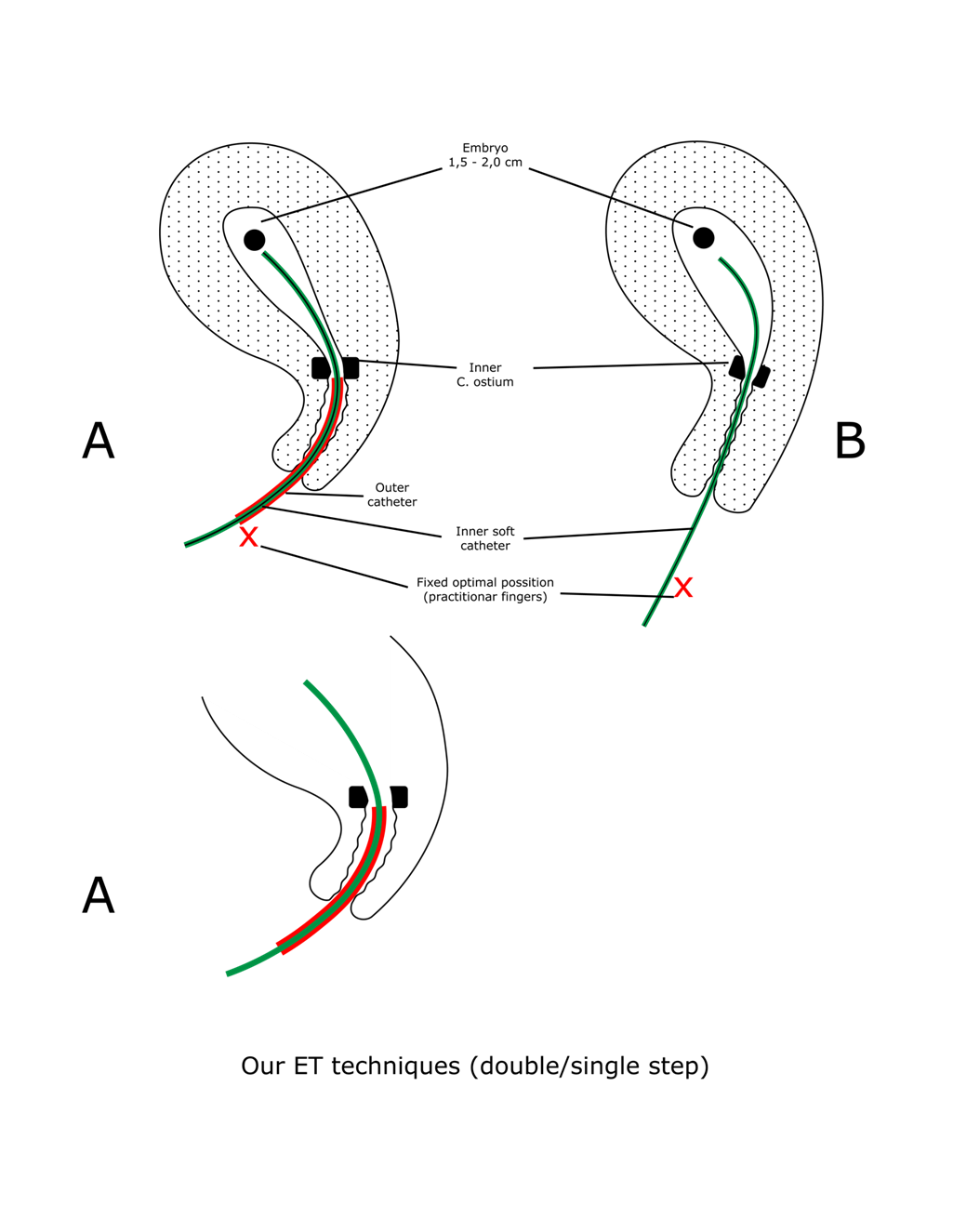 Embrio transfer - Prof. dr. sc. Velimir Šimunić