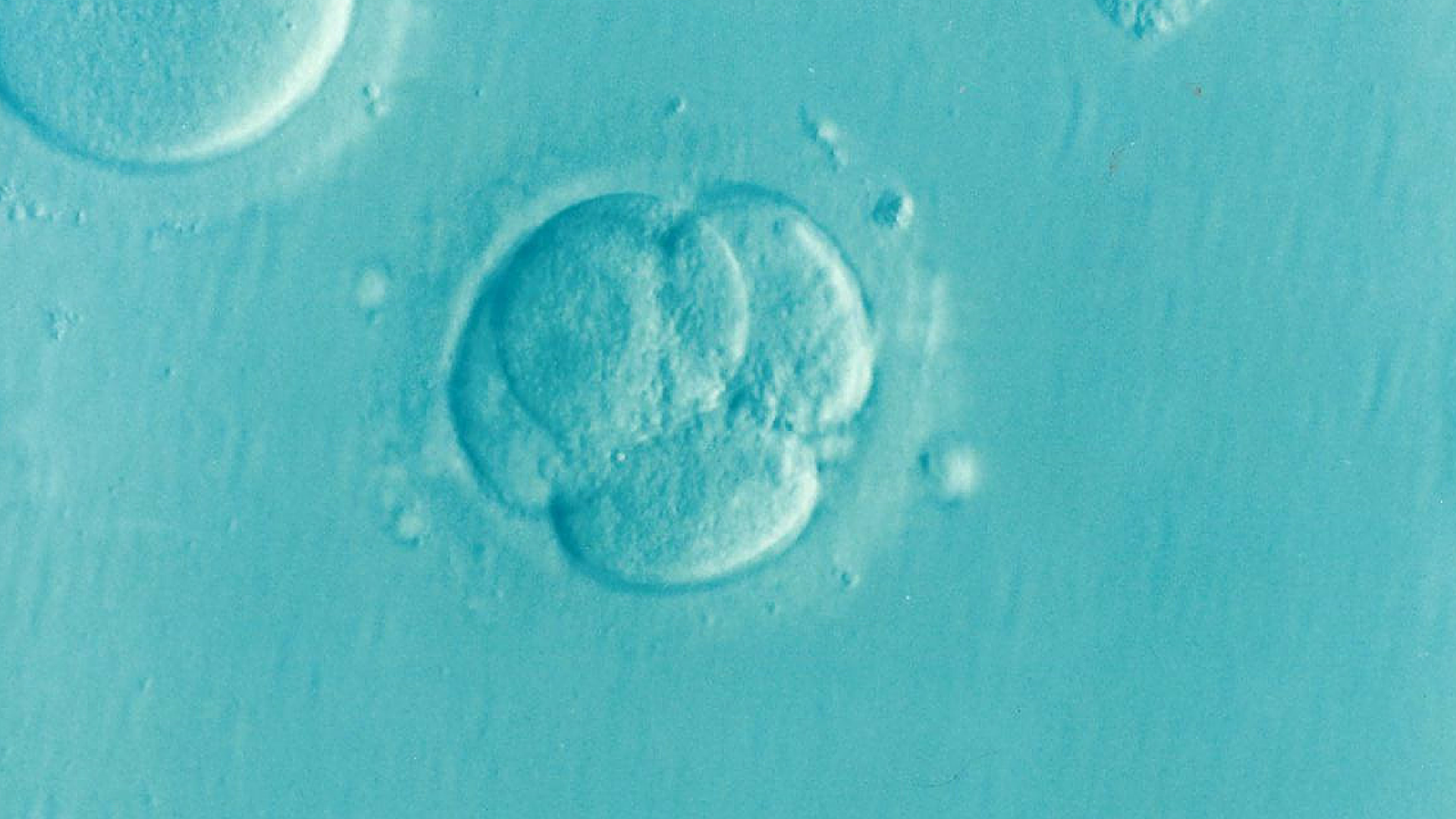 Istine i zablude o embrio transferu